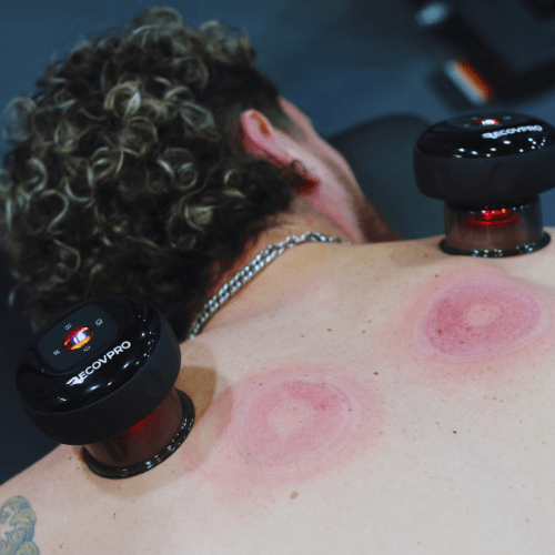 Ventouse Électrique | RecovPro